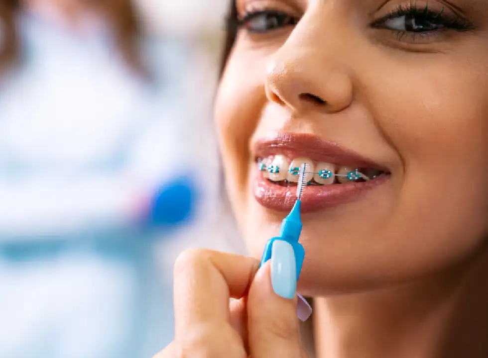 How Braces Can Improve Your Oral Health